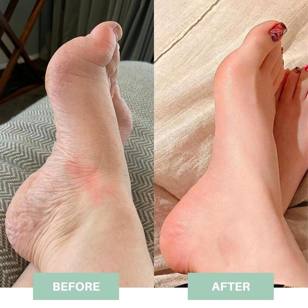 EMS Massage Foot Pad 6 Modes 9 Strength Levels Rechargeable